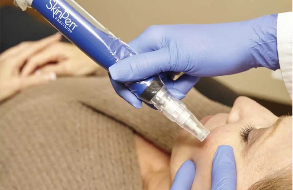 Top 10 Benefits of PRP and PRF in Skin Rejuvenation