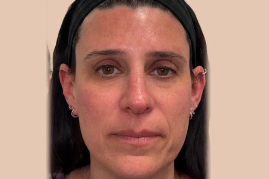 EZ Gel & Botox