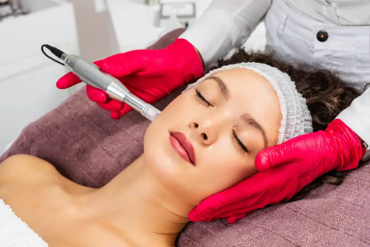 Microneedling with SkinPen Benefits, Procedure and Results by Rev Facial Bar in Middletown, NY