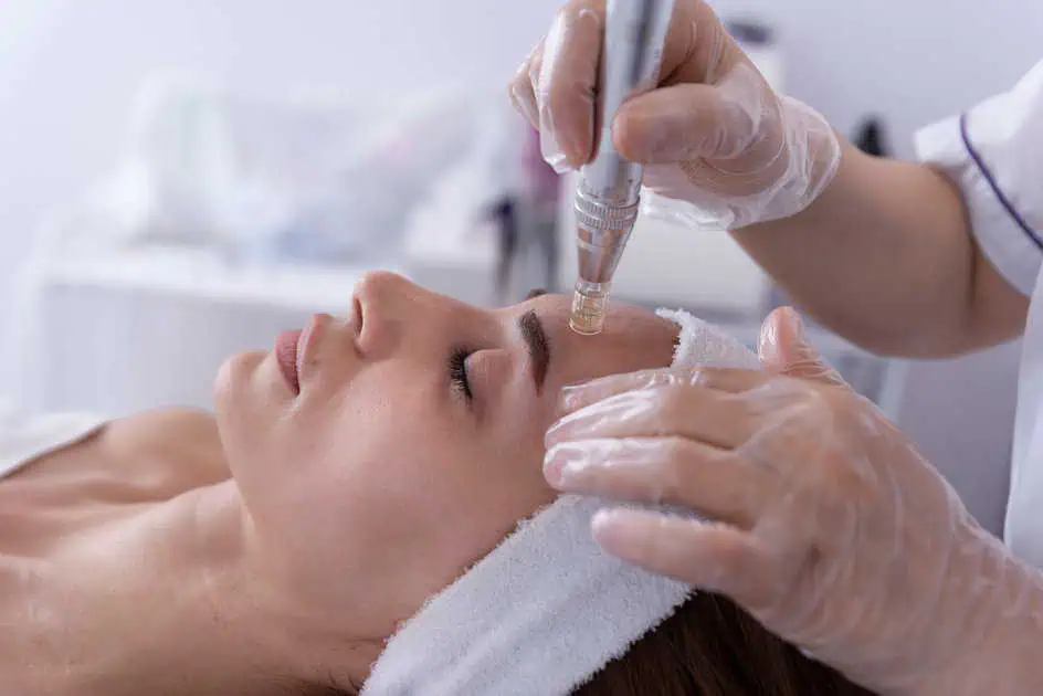 MicroTox Treatment in Middletown, NY by Rev Facial Bar