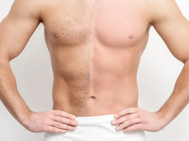 laser-hair-removal-two-in-middletown-ny